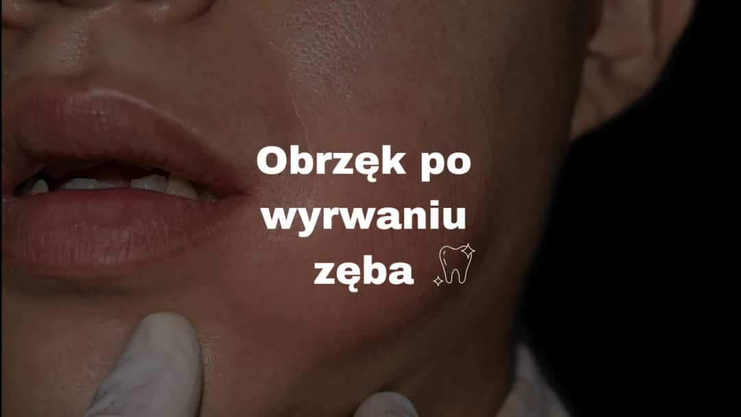 Szybkie gojenie po ekstrakcji zęba: uniknij bólu i powikłań!