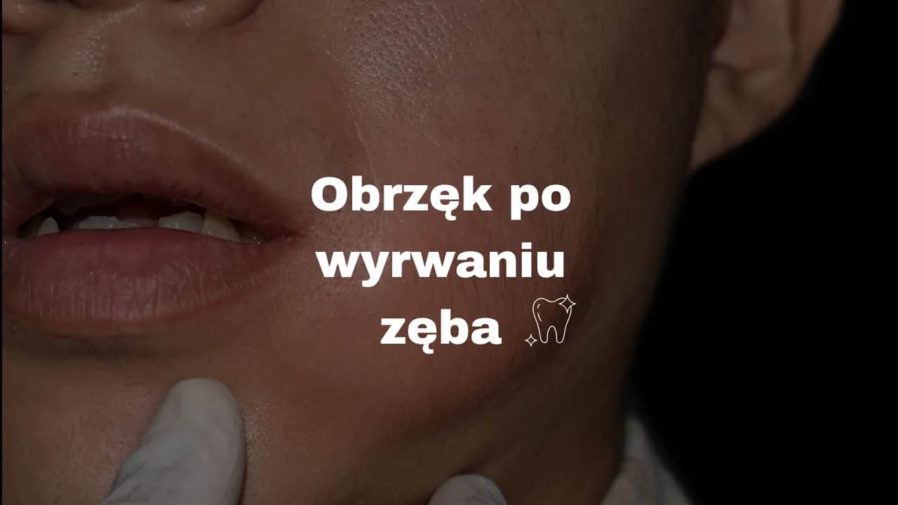 Szybkie gojenie po ekstrakcji zęba: uniknij bólu i powikłań!