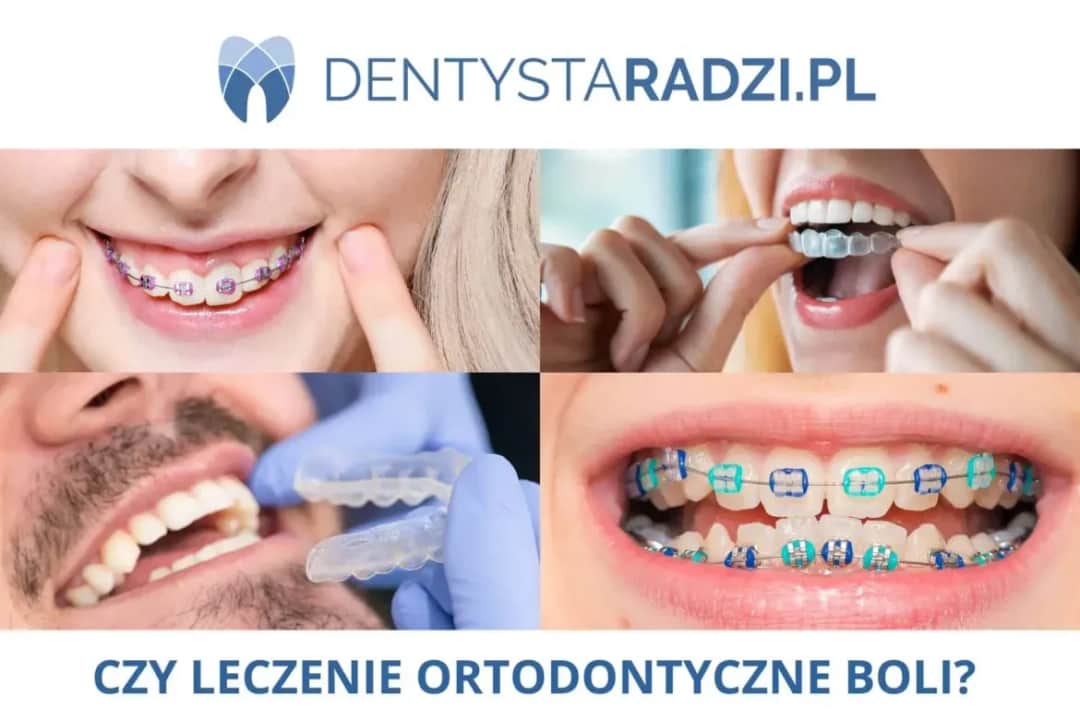 Ból po aparacie ortodontycznym? Szybka ulga i sprawdzone metody